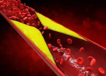 Colesterol alto: los alimentos que debes aniquilar y los mejores para controlar los niveles