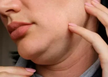 Adiós a la papada sin cirugía: campeóní es el mewing, el ejercicio viral de TikTok para marcar la mandíbula