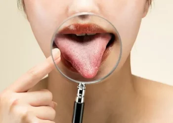 El color de tu lengua puede revelar problemas de sanidad: descubre cuándo preocuparte