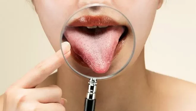 El color de tu lengua puede revelar problemas de sanidad: descubre cuándo preocuparte