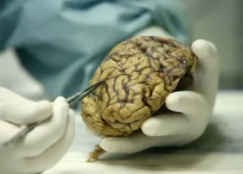 afectuoso a la báscula: Este es el riesgo que tienes de sufrir alzhéimer, según el peso