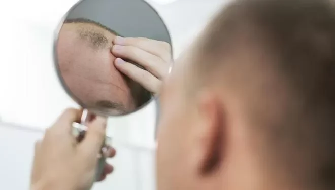 Sirve de ingenuidad la biotina, la vitamina de moda para evitar la caída del cabello y fortalecer las uñas