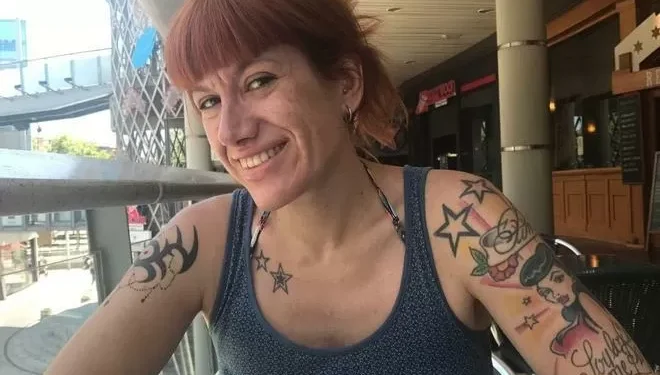 “Mi nariz crecía y los zapatos ya no me valían: número unoí descubrí que tenía acromegalia”